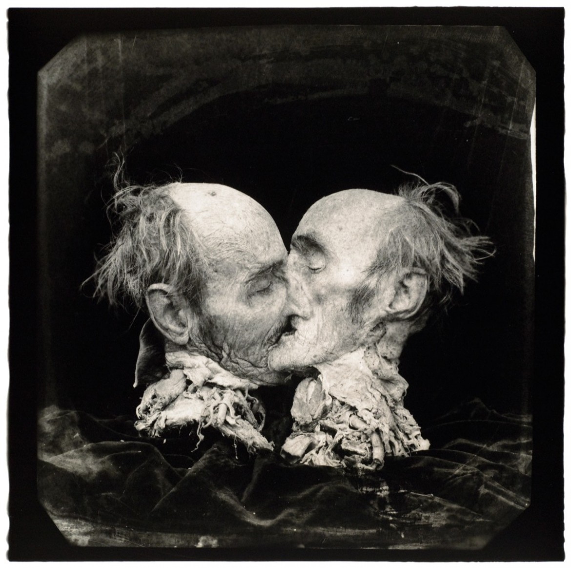 The Kiss -  Joel-Peter Witkin - 1982